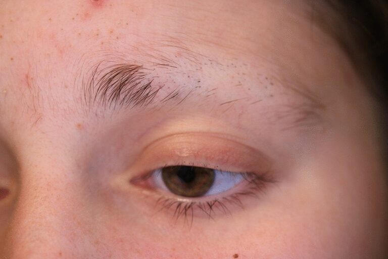 Arti Mimpi Alis Rontok