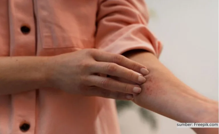 Arti Mimpi Tentang Gatal-Gatal: Pertanda, Makna Psikologis & Angka Erek-Erek 2D 3D 4D